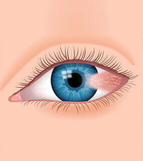Best Eye Care Doctors Hyderabad