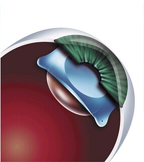 Best Eye Specialist in Hyderabad