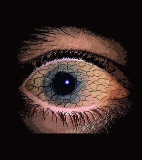 Eye Hospital in Hyderabad