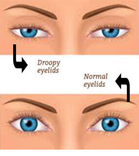 Best Eye Specialist in Hyderabad