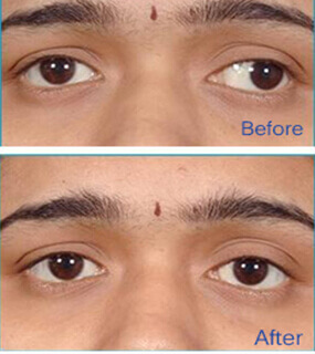 Best Eye Specialist in Hyderabad