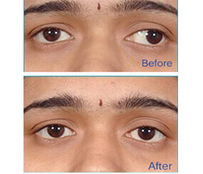 Top and Best Eye Hospitals in Hyderabad